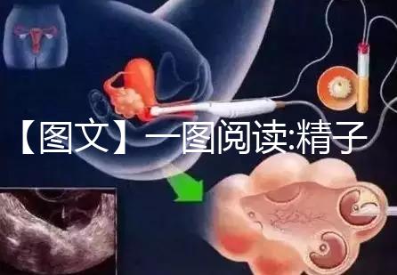 【圖文】一圖閱讀:精子和卵子結合有多難！