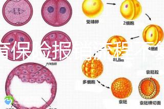 生育保險報銷流程不復(fù)雜，辦理地點(diǎn)不分地域異地可報銷
