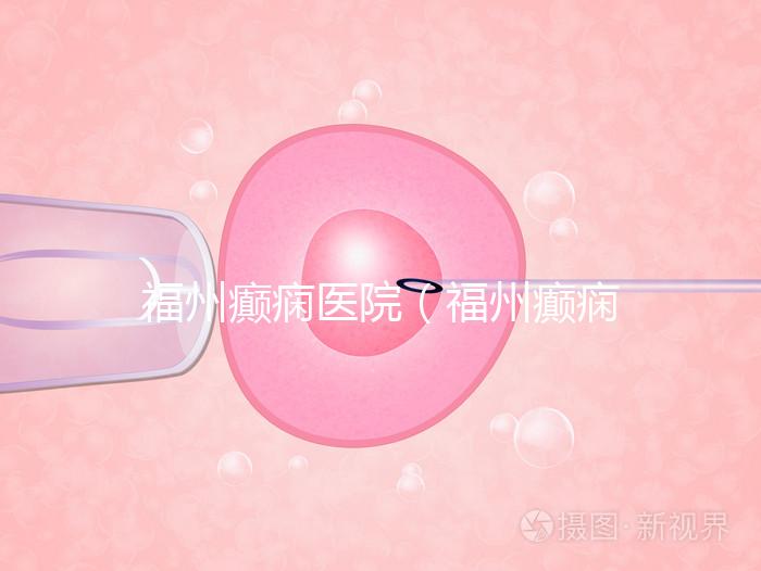 福州癲癇醫院(福州癲癇醫院在哪里)