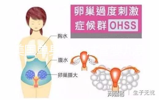 美國單身做個試管嬰兒費用大概要多少？