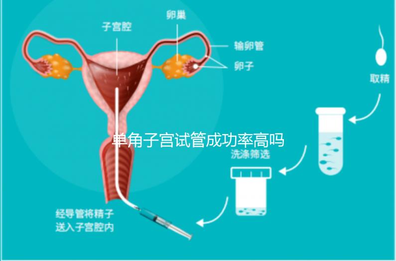 單角子宮試管成功率高嗎?送你5招降低胚胎著床的難度