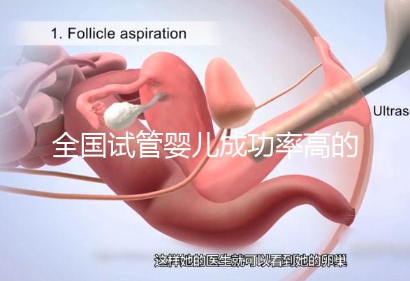 全國試管嬰兒成功率高的醫院有哪些？（全國試管嬰兒成功率高的醫院目錄一覽）