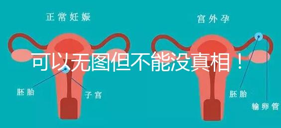 可以無圖但不能沒真相！段濤大夫帶你了解B超檢查報(bào)告單