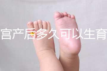 剖宮產(chǎn)后多久可以生育二胎？