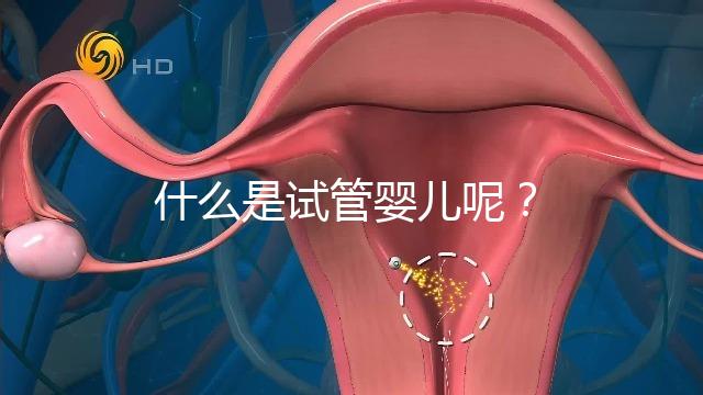 什么是試管嬰兒呢?