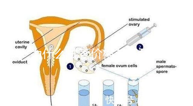 為什么試管價格差異那么大？做試管到底要花多少錢？