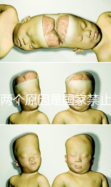 有兩個原因是國家禁止中非混血中國會接受嗎？