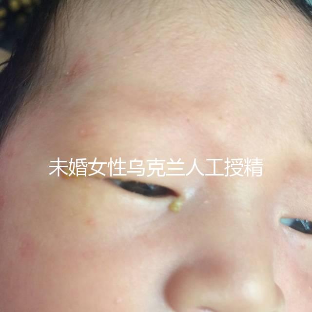 未婚女性烏克蘭人工授精必看！醫(yī)療及生活費用明細(xì)預(yù)覽