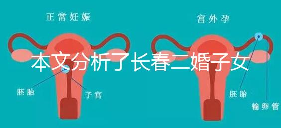 本文分析了長春二婚子女是否有補(bǔ)貼,每孩獎勵(lì)1萬元,抓緊了解