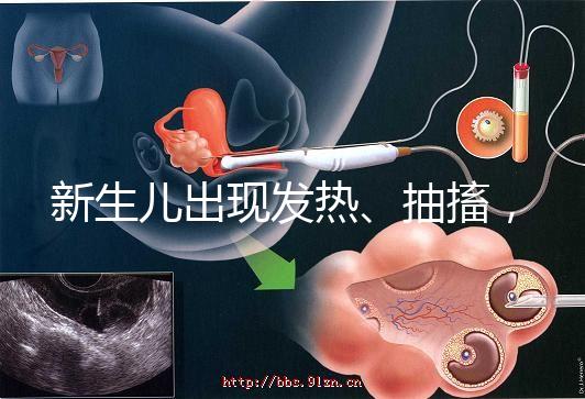 新生兒出現發熱、抽搐,很可能是胎毒的表現