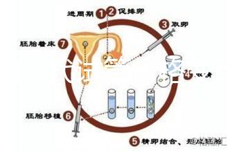 泰國三代試管價(jià)格變動(dòng)，2025年最新費(fèi)用行情一覽