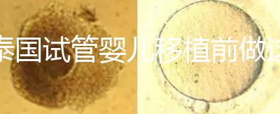 泰國試管嬰兒移植前做這3件事能提高成功率，不然會(huì)后悔！