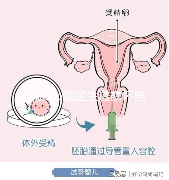 孕檢時b超醫生透露懷男寶女寶暗語寶典，一語戳中有心人！
