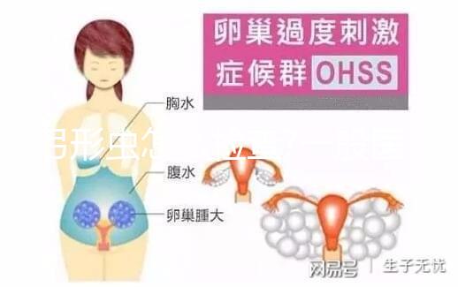 弓形蟲(chóng)怎么檢查?一般醫(yī)生會(huì)建議查torch全套