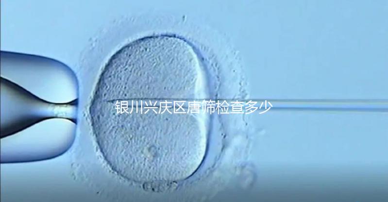 銀川興慶區(qū)唐篩檢查多少錢取決于情況,2024年國家免費限額