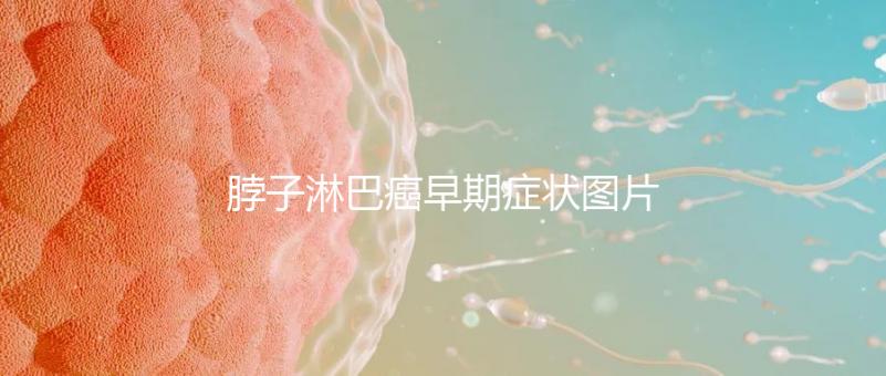 脖子淋巴癌早期癥狀圖片(脖子上有結節的圖片)