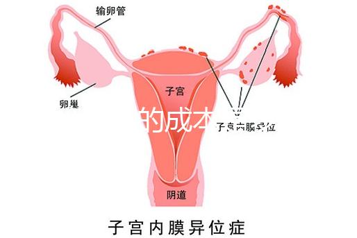 試管嬰兒的成本是多少?需要多少錢?