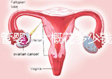 試管嬰兒大概花多少錢（試管嬰兒大概花多少錢費(fèi)用）