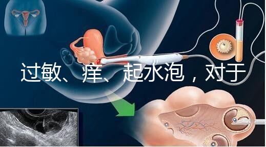 過敏、癢、起水泡,對(duì)于三伏貼的副作用你需知道該怎么辦