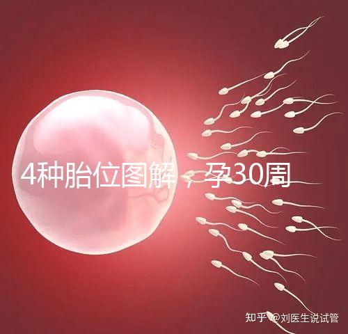 4種胎位圖解,孕30周這個姿勢最適合順產(chǎn)