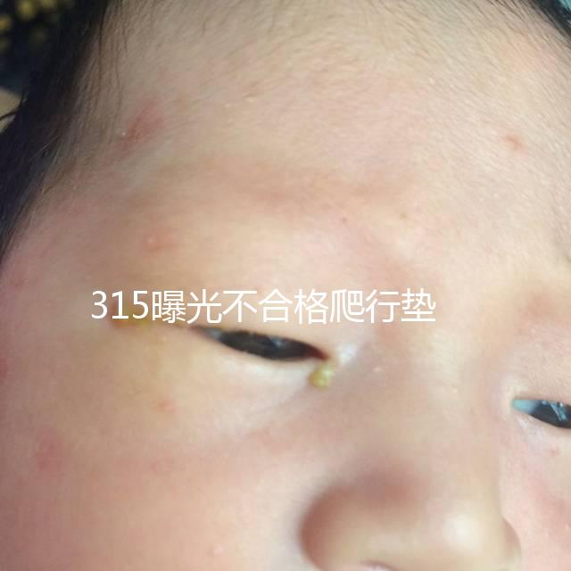 315曝光不合格爬行墊品牌，甲酰胺超標的危害可不小